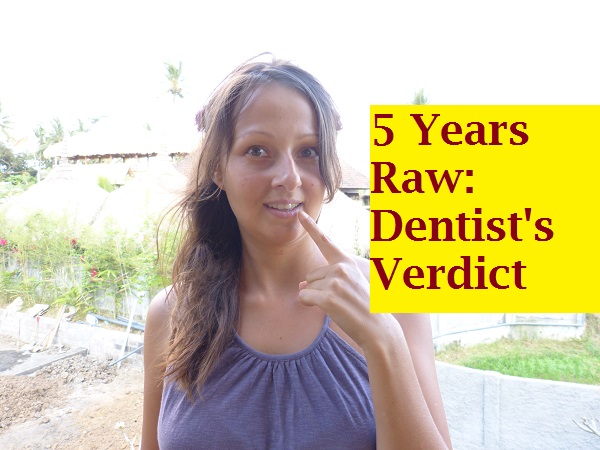 What 5 Years On A High-Carb Fruitarian Raw Food Diet Did To My Teeth