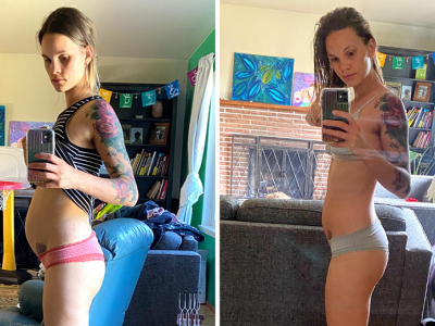 Gut Cleanse Before And After Results – Candida Acne And Weight Loss