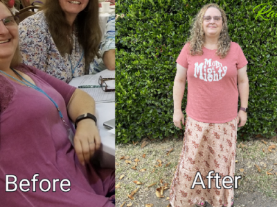 Hormone Reset With 20 lbs Of Weight Loss, Inflammation Reduction And Migraines Gone