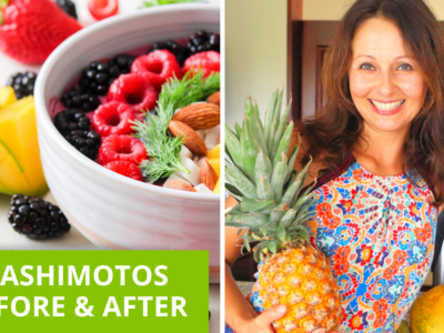 How I Reversed Hashimotos Before And After Story